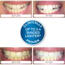 Rio Hammaste valgendamine DCWU-EU/1,6, 15min, 20 protseduuri, 1 otsik, 16 LED, Blue-Light Teeth Whitening&trade;