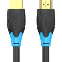 Vention HDMI kabelis 0.75M AACBE, 4K 60Hz, 18 Gbit/s, 3D, auksiniai jungtys, juodas