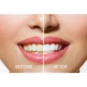 Rio Hammaste valgendamine DCWU-EU/1,6, 15min, 20 protseduuri, 1 otsik, 16 LED, Blue-Light Teeth Whitening&trade;