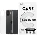 Care Aizsargkorpuss X-Ray 1443, 35g, 1.27cm, 8.113cm, 16.426cm, pa&scaron;atjaunojo&scaron;s TPU, Apple iPhone 16 Plus